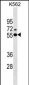 ESR2 Antibody (Center) (Ascites)