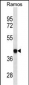 HLA-B Antibody