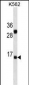 IL2 Antibody (Center) (Ascites)