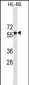 CCR7 Antibody (N-term) (Ascites)