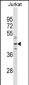 FH Antibody (N-term) (Ascites)