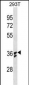 IL1B Antibody (Center) (Ascites)