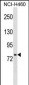 HNF1A  Antibody (Ascites)