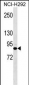 JUP  Antibody (Ascites)