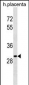 OR5B12 Antibody (C-term)