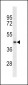 SRD5A2L2 Antibody (C-term) (Ascites)