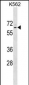 TP63 Antibody (Ascites)