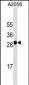 MART-1/Melan-A Antibody (C-term) (Ascites)