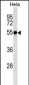 FGG  Antibody (Ascites)