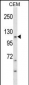 KIT Antibody (Ascites)