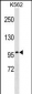 ITGB2 Antibody