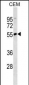 IGHD Antibody (N-term) (Ascites)