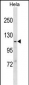 MVP Antibody (N-term) (Ascites)