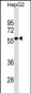 CD33 Antibody