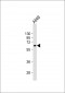 PODXL Antibody (C-term) (Ascites)