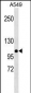 MLH1 Antibody (Center) (Ascites)