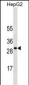 SOCS3 Antibody (Ascites)