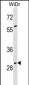GAS2 Antibody (N-term)