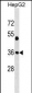 JUN Antibody (Center T93)