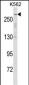 SCN5A Antibody (N-term)