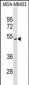 ITPK1 Antibody (N-term)
