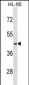 MC5R Antibody (C-term)