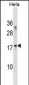 RPL36A Antibody (C-term)