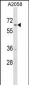 TRIM35 Antibody (C-term)