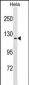 TRPV4 Antibody (N-term)