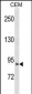 PREP Antibody (Center)