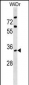 ARPC2 Antibody (C-term)