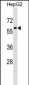 TFEB Antibody (Center)