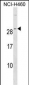 RALA Antibody (C-term)