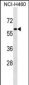 ZNF37A Antibody (N-term)