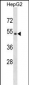 NR1H4 Antibody (N-term)