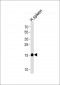 RNASE2 Antibody (C-term)