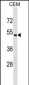 SSTR5 Antibody (C-term)