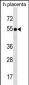 FZR1 Antibody (N-term)