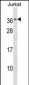 RAB8B Antibody (C-term)