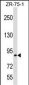 RASA3 Antibody (C-term)