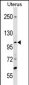 SCUBE3 Antibody (Center)