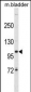 SCUBE3 Antibody (Center)