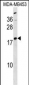 LYPLA1 Antibody (Center)
