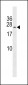 TAK1L Antibody (C-term)