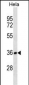 TBCB Antibody (N-term)