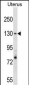 RFC1 Antibody (N-term)