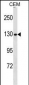 NCAPG Antibody (N-term)