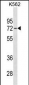 IL22RA1 Antibody (C-term)