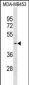 SUV39H2 Antibody (C-term)