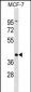 DMRT1 Antibody (C-term)